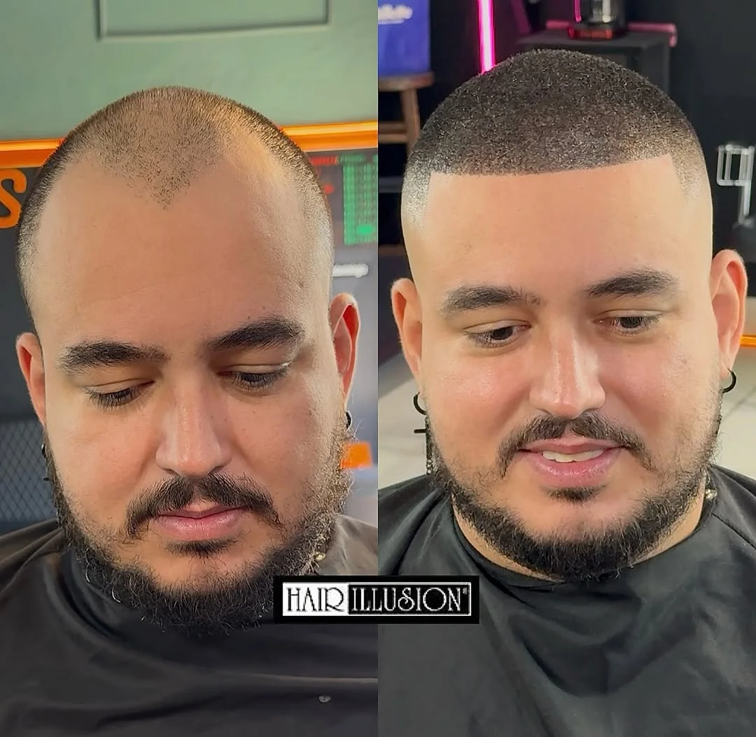 Before and after 3